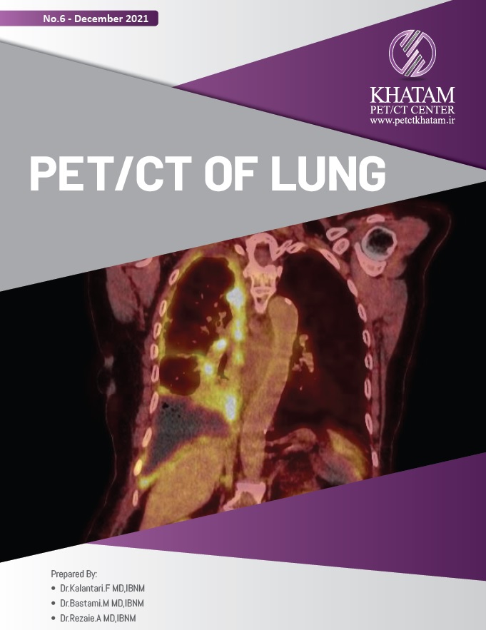 PET/CT OF LUNG, No.6- December 2021